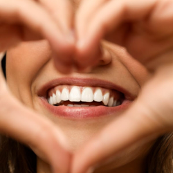 Veneers