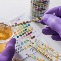 Urine Drug Screens