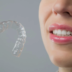 Mouth Guards