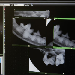 Digital X Ray