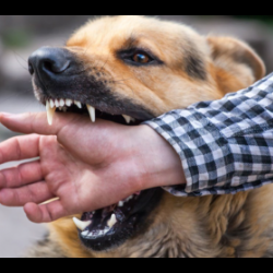 Dog bites
