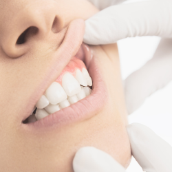 Periodontal Care