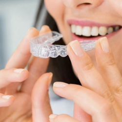 Invisalign Clear Aligners