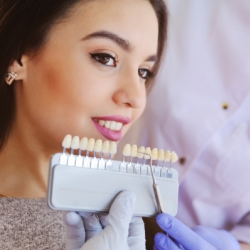 Veneers