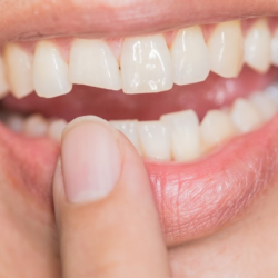 Restorative Dentistry