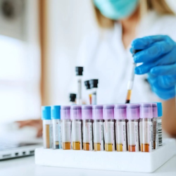 Clinical Trials