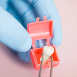 Wisdom Teeth Removal