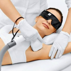 Laser hair removal