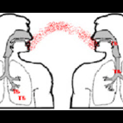 Tuberculosis (TB) Services