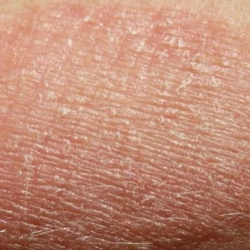 Is Your Water Destroying You Skin?