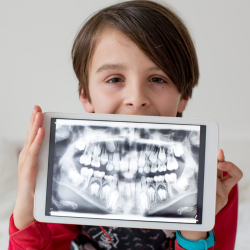Dental X-rays