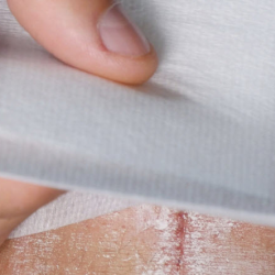 Wound Cultures and Biopsies