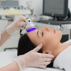 Radiofrequency with microneedles