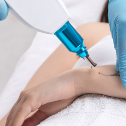 Tattoo and Permanent Makeup Removal