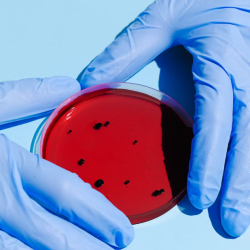 Ivermectin