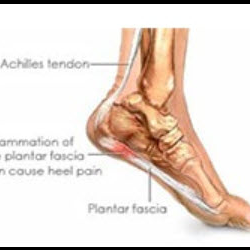 Heel Pain