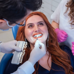Veneers