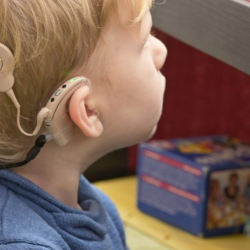 Cochlear Implants