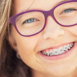 Traditional & Clear Braces