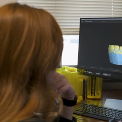 Same-Day Crowns & Bridges