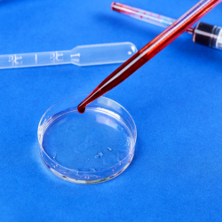PDGF (Platelet Derived Growth Factor)