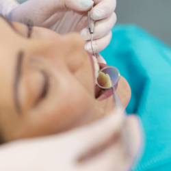 Root Canal Treatments