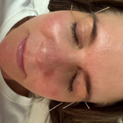 Facials