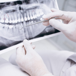 Supplemental Dental and Vision Insurance