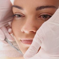 Dermaplaning