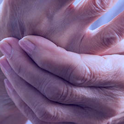 Arthritis Care