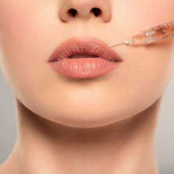 Dermal Fillers