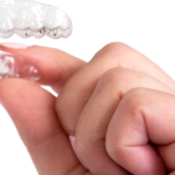 Clear Aligners (Invisible Braces)