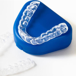 Clear Aligners