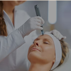 Microneedling