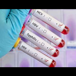STD Test