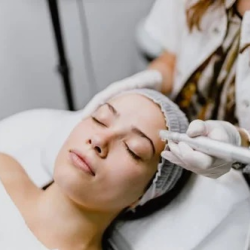 Microneedling