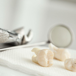 Extractions