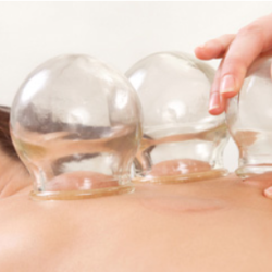 Cupping Therapy