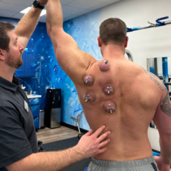Muscle Cupping