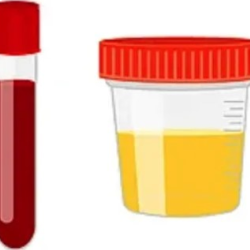 Labs