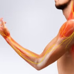 Neuropathic Pain