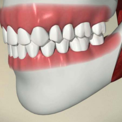 Dental Exams and Professional Cleanings
