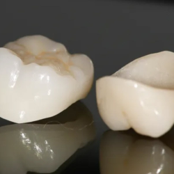 Dental Crowns