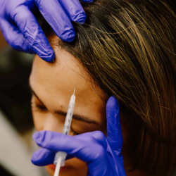 Dermal Fillers