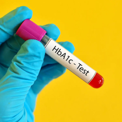 Endocrinology and Diabetes