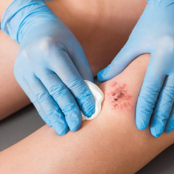 Evidence-based Treatment