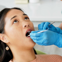 Root Canal Treatment