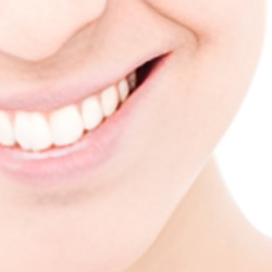 Teeth Whitening