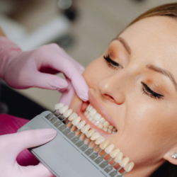 Professional Teeth Whitening