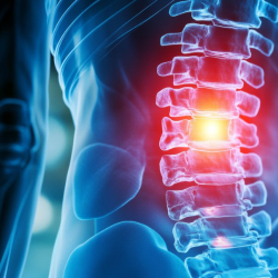 Kyphoplasty with Spine Jack Placement